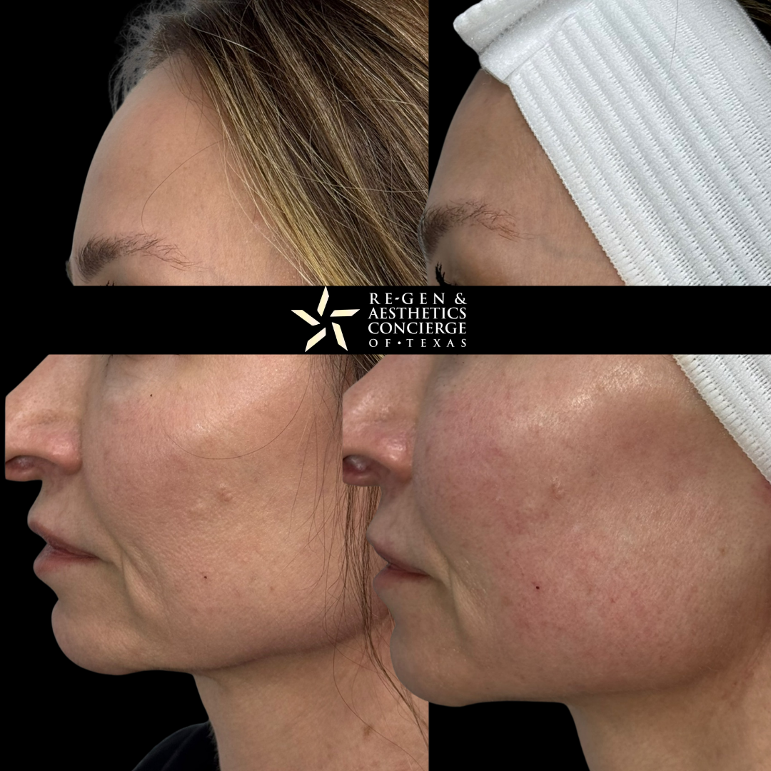 XERF BEFOREAFTER PHOTOS 4
